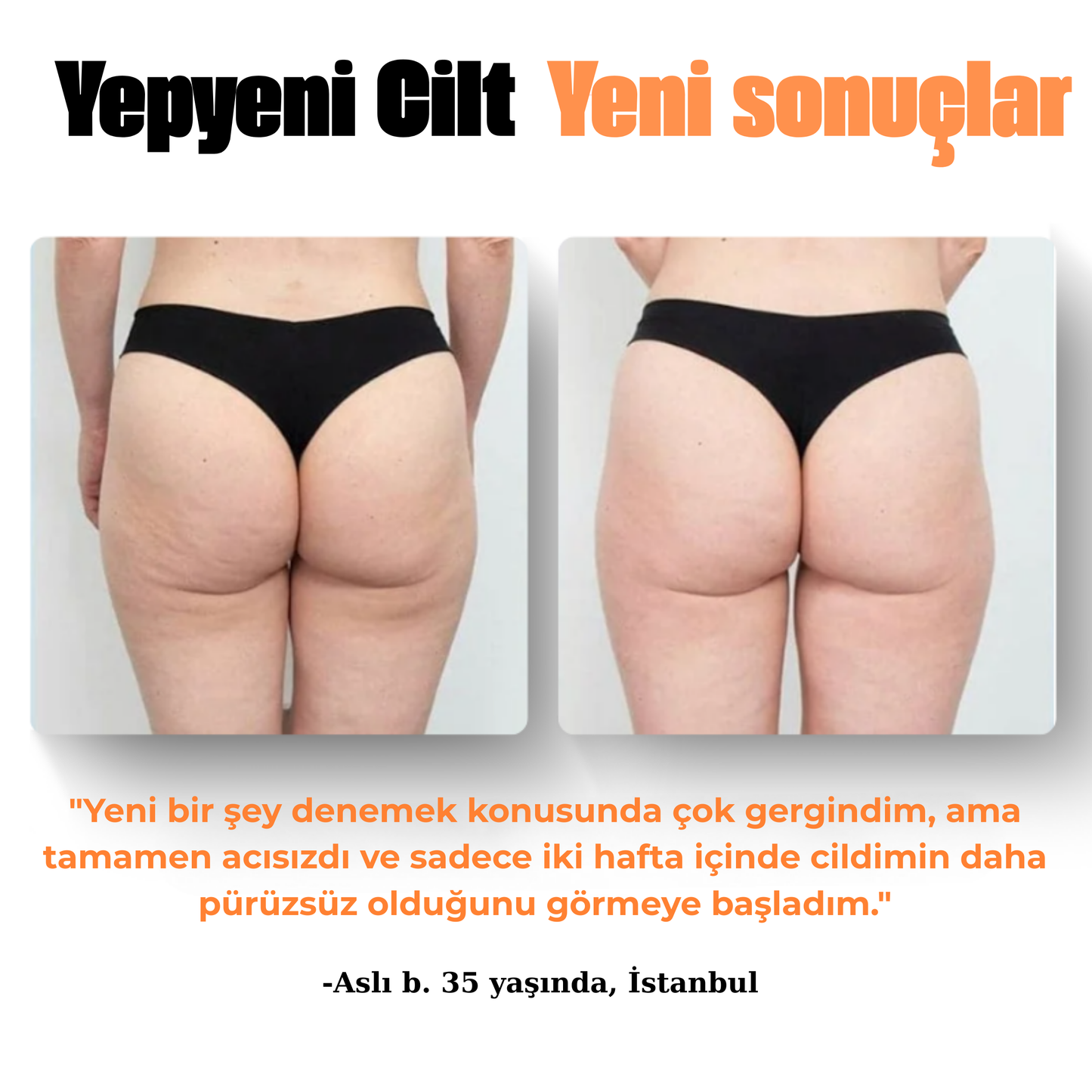Vpag Selülit Aleti