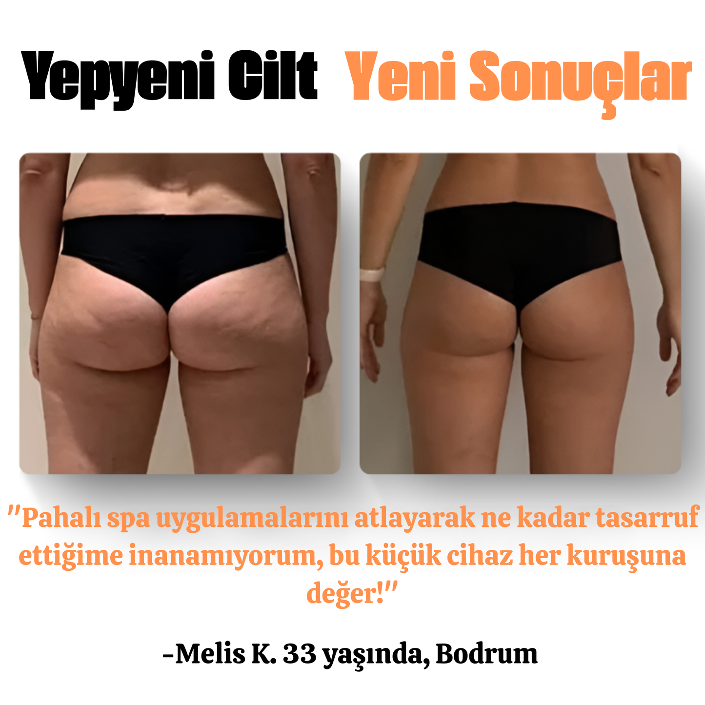 Vpag Selülit Aleti